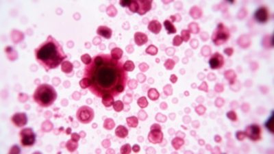 kondisi darah langka