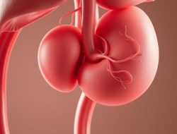 Memahami Penyakit Cholangiocarcinoma: Gejala, Penyebab, dan Pengobatan