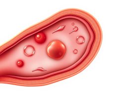 Memahami Penyakit Esofagitis: Gejala, Penyebab, dan Pengobatan