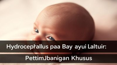 Hydrocephalus pada bayi baru lahir