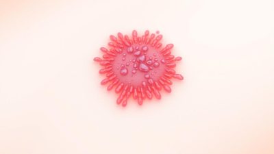 penyakit Hemangioma