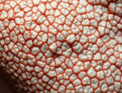 Penyakit Iktiosis: Fakta, Diagnosis, dan Penanganan Terbaik