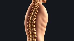 Kifosis: Mengenal Kelainan Tulang Belakang yang Perlu Diwaspadai