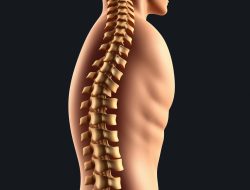 Kifosis: Mengenal Kelainan Tulang Belakang yang Perlu Diwaspadai