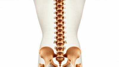 penelitian Lordosis