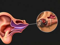 Mengatasi Penyakit Labirinitis: Panduan Lengkap