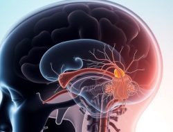 Memahami Malformasi Chiari: Gejala, Penyebab, dan Penanganan